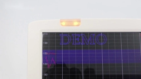 Baby Heart Monitor with ECG, SpO2, Resp, NIBP/ 12.1 Screen Fetal Monitor